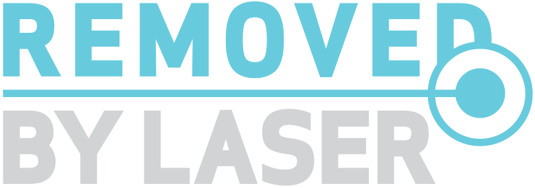 Removed by Laser: Modern och säker laserteknik